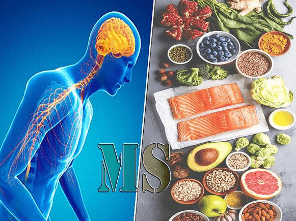 نقش رژیم گرفتن در بیماری ام اس 5 نقش رژیم گرفتن در بیماری ام اس
