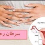 سرطان دهانهٔ رحم
