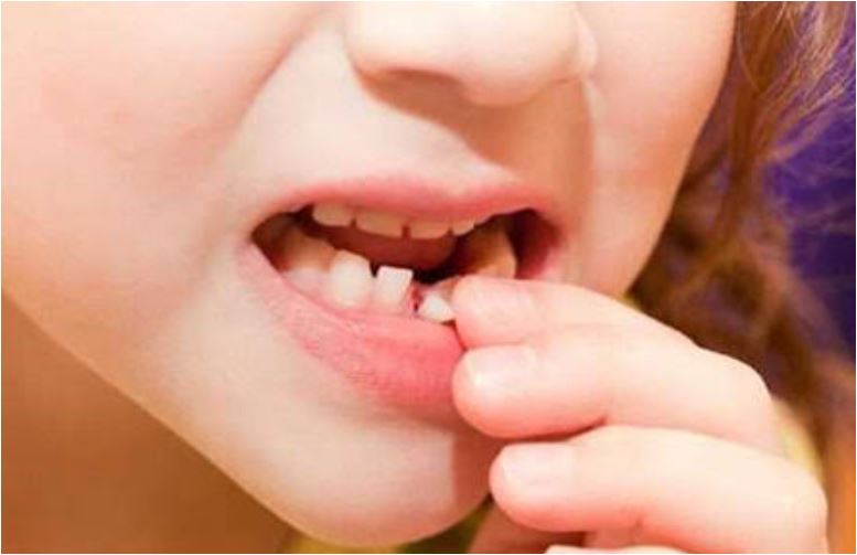 تعبیر افتادن دندان از دیدگاه روانشناسی و یونگ