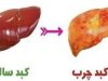 بیماری کبد چرب