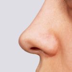 تعبیر خواب بینی، دماغ در خواب نشانه چیست؟