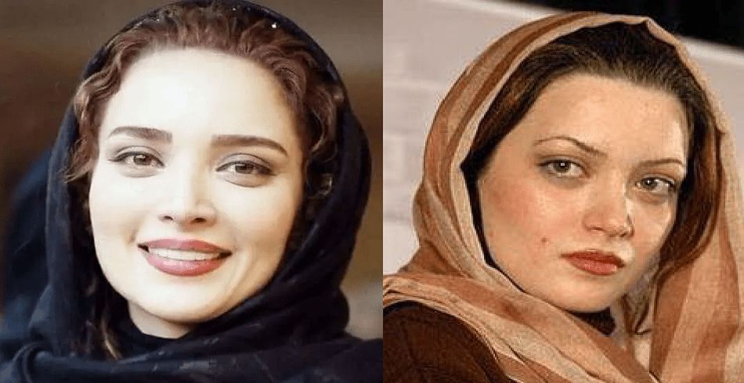 عمل زیبایی بهنوش طباطبایی
