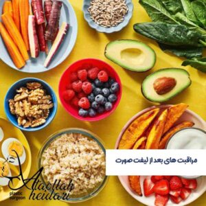 مراقبت های بعد از لیفت صورت