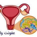 7 اشتباه رایجی که احتمال عفونت واژن را افزایش می‌دهند