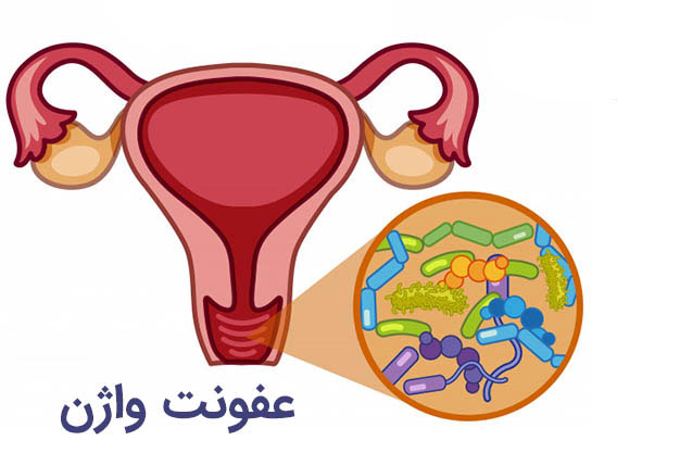 7 اشتباه رایجی که احتمال عفونت واژن را افزایش می‌دهند