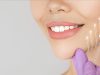 مقایسه لیفت با نخ با هایفو و بوتاکس؛ کدام ماندگارتر است؟