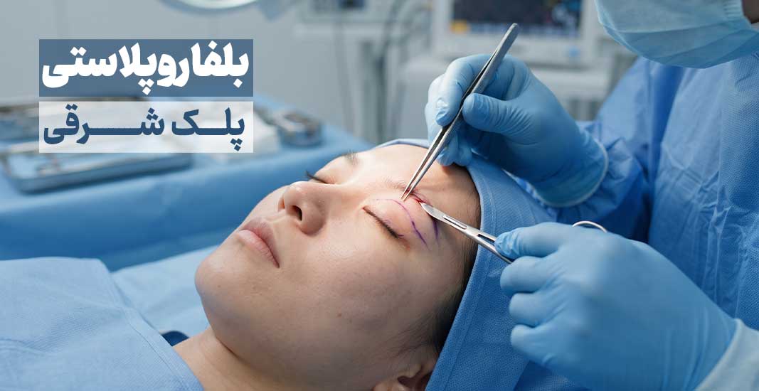 عمل چشم شرقی | پاسخ به تمام سوالات و دغدغه‌های قبل از جراحی